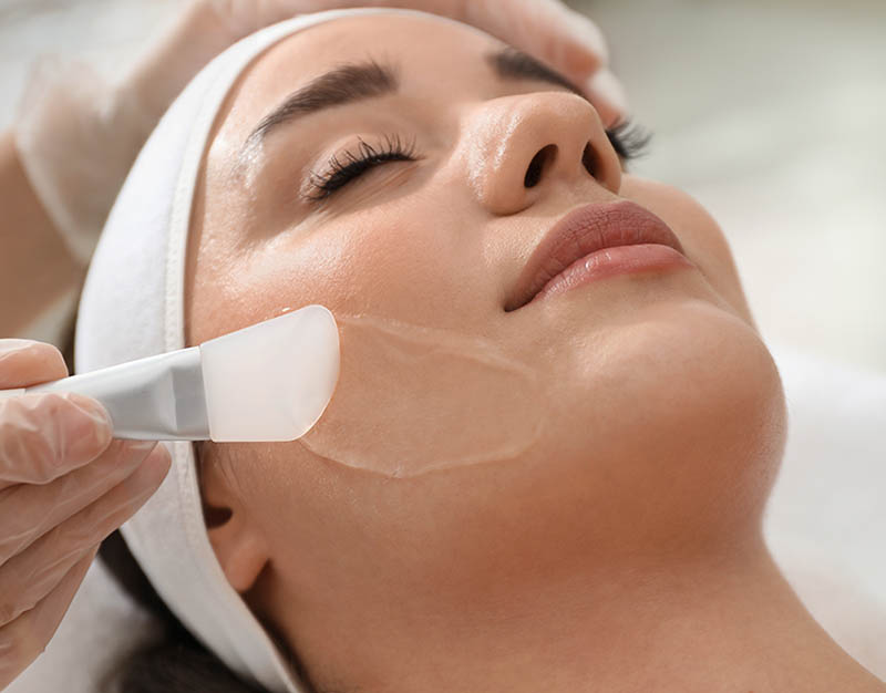 Chemical Peel